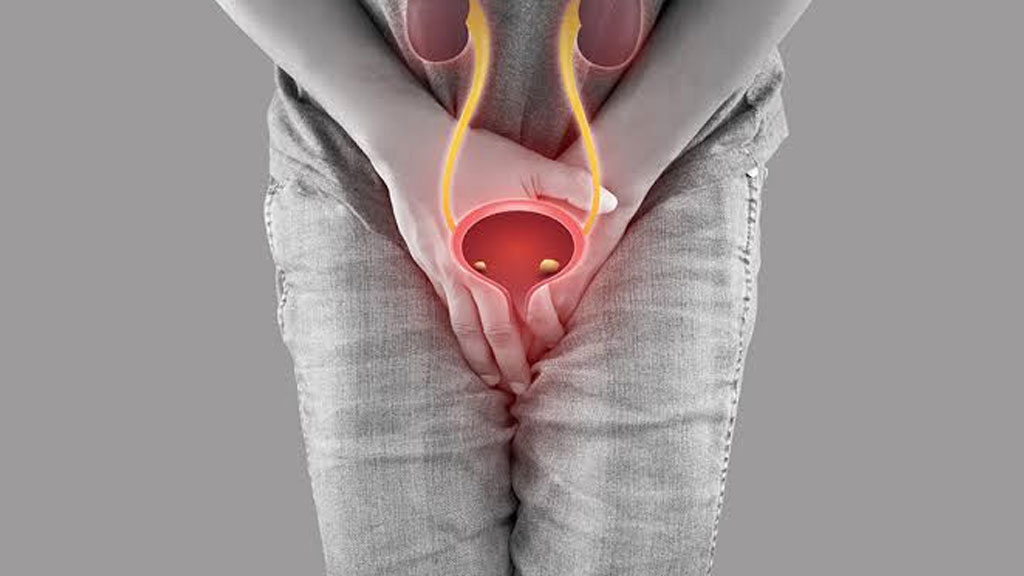 Urinary Incontinence