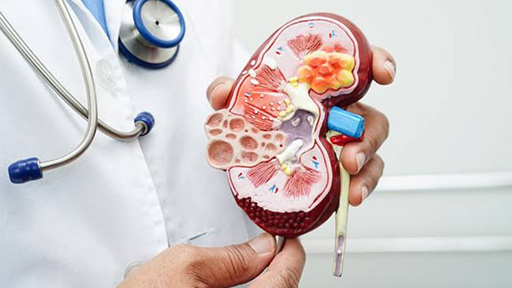 General Urology